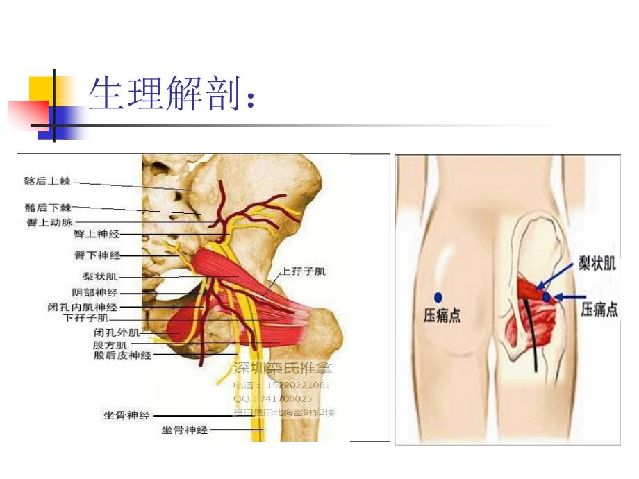 梨状肌综合征图文课件_1_第3页