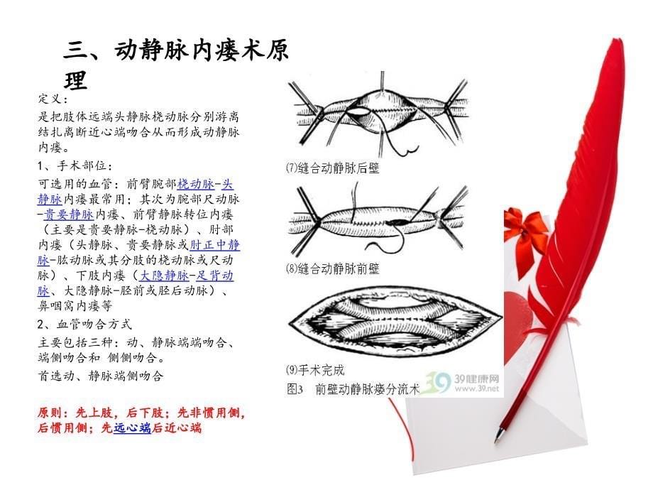 动静脉内瘘形成术及护理图文课件_第5页