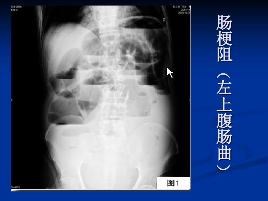 线总结课件_第4页