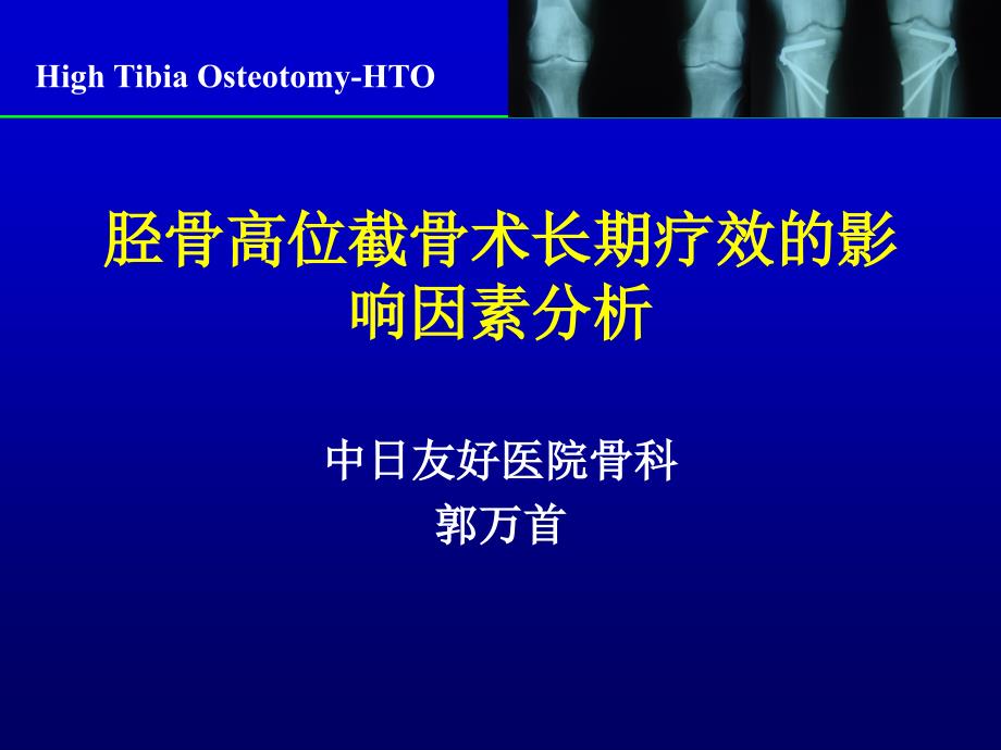 胫骨高位截骨术长期疗效的影响因素分析课件_第1页