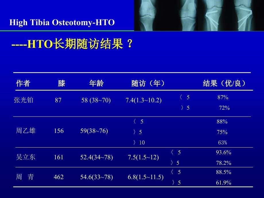 胫骨高位截骨术长期疗效的影响因素分析课件_第5页