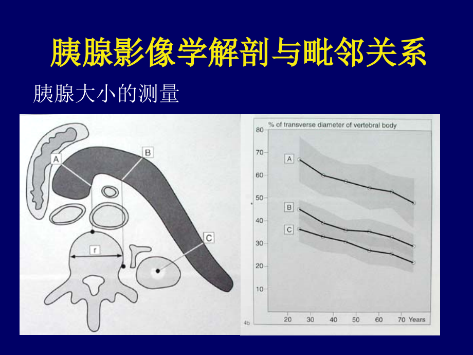 胰腺肿瘤影像学ppt课件_第4页