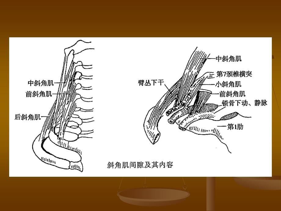 前斜角肌综合征课件_第5页