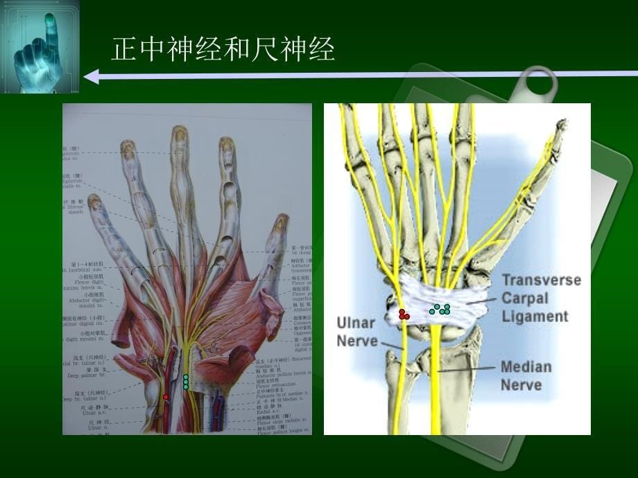 手部神经损伤图文课件_第5页