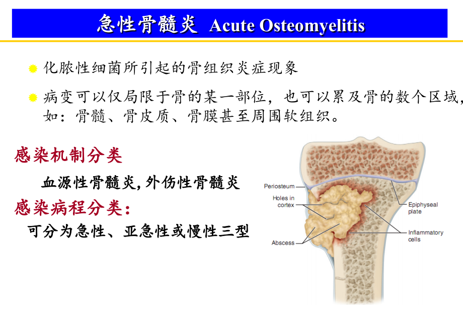 感染性与非感染性骨关节炎课件_第4页