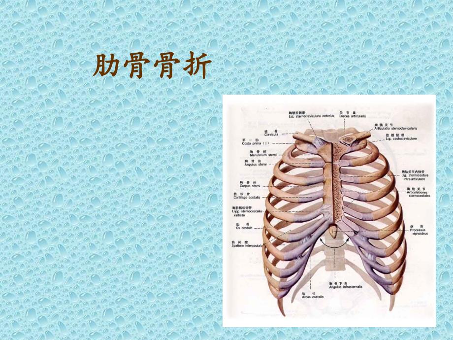 肋骨骨折的护理课件_3_第1页