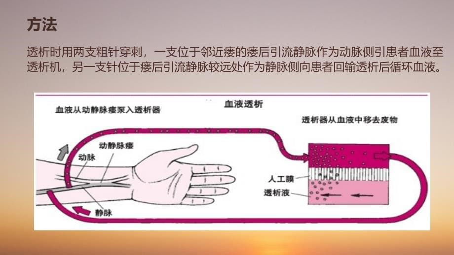 动静脉内瘘的超声检查课件_第5页