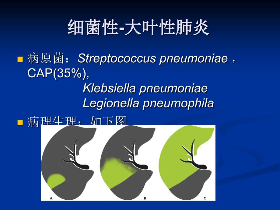 肺部感染-影像学和病理_ppt课件_第3页