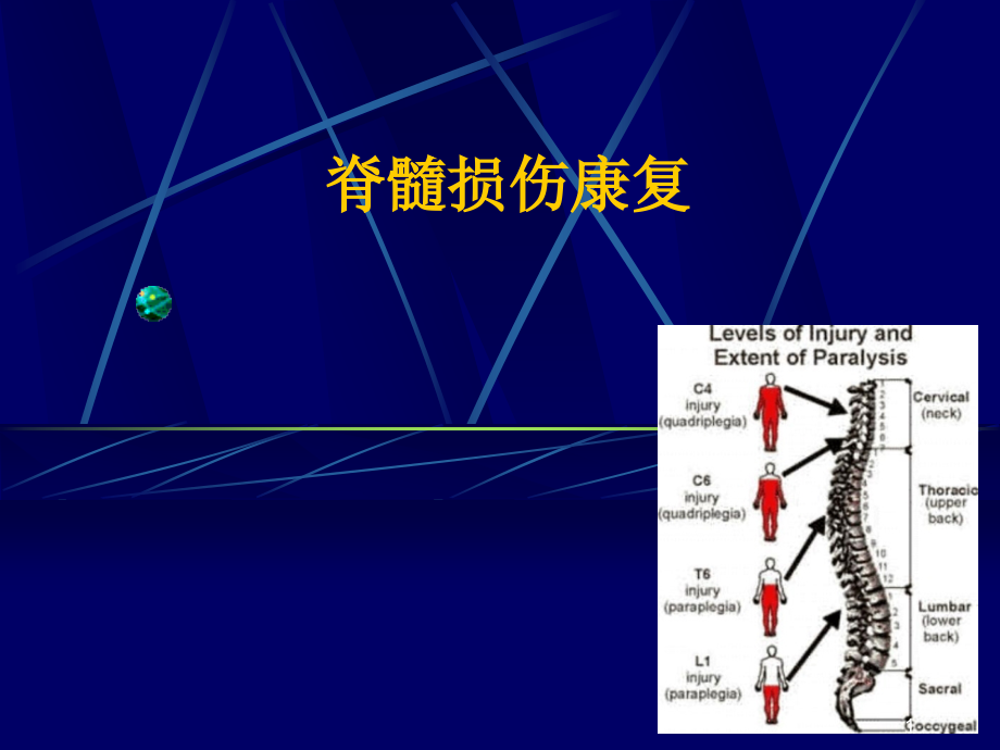 脊髓损伤康复课件_5_第1页