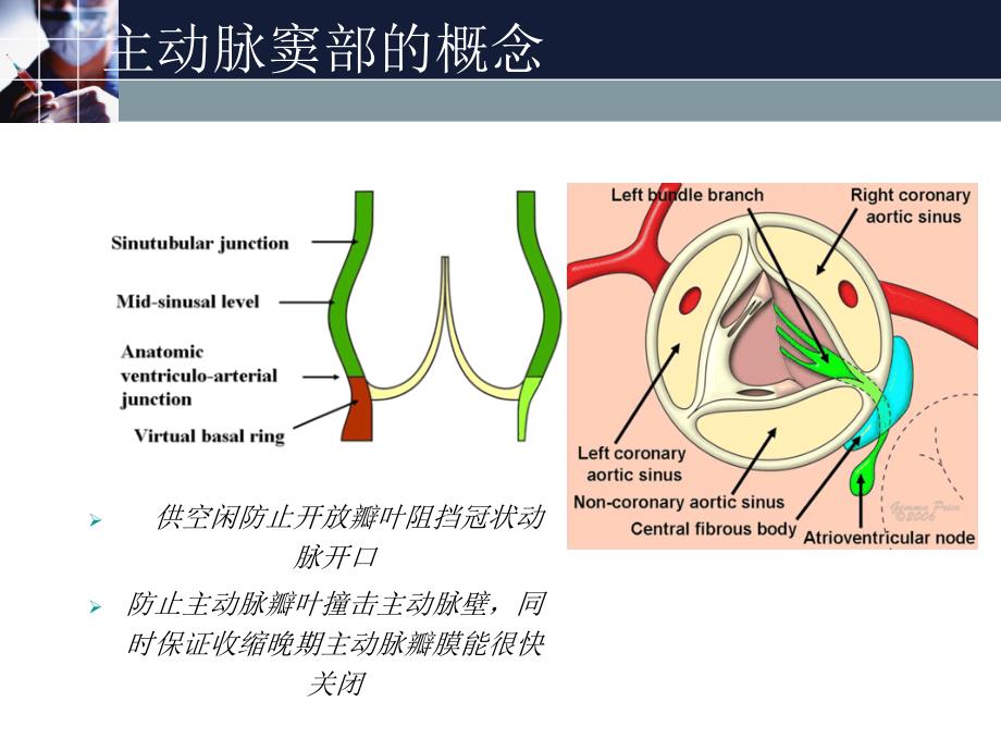 主动脉窦动脉瘤课件_2_第3页