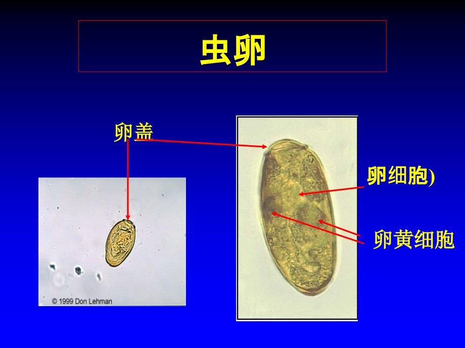 姜片虫并殖吸虫课件_第4页