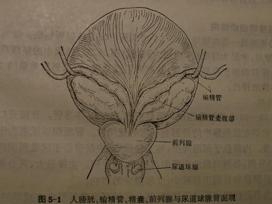 医学类良性前列腺增生症（bph）课件_第2页