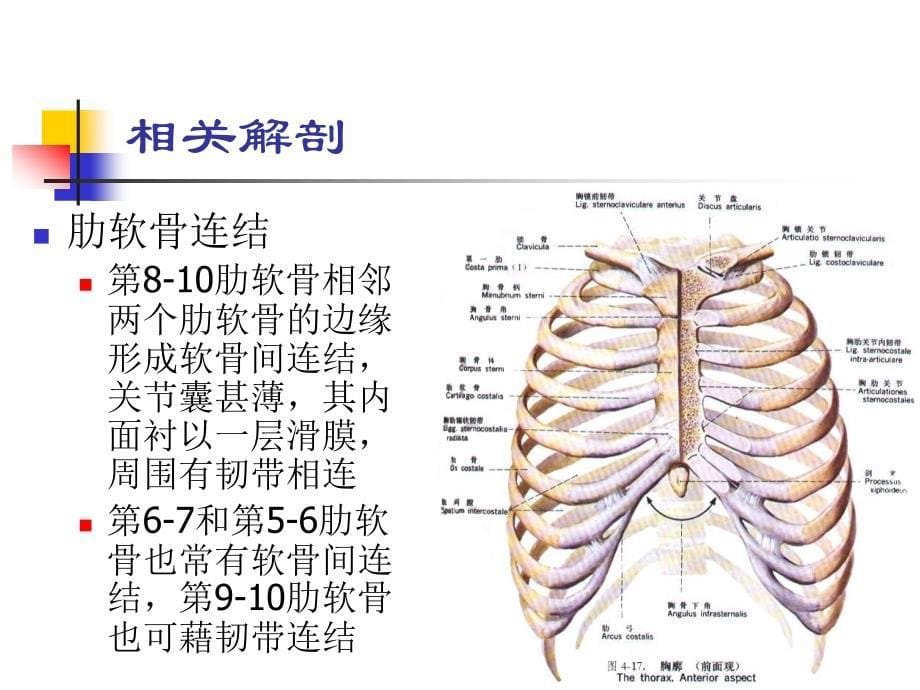 肋软骨炎课件_1_第5页