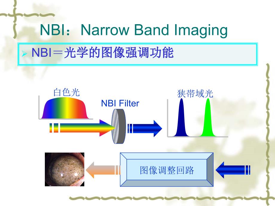 窄带成像(nbi)在内镜诊疗中的应用_第3页