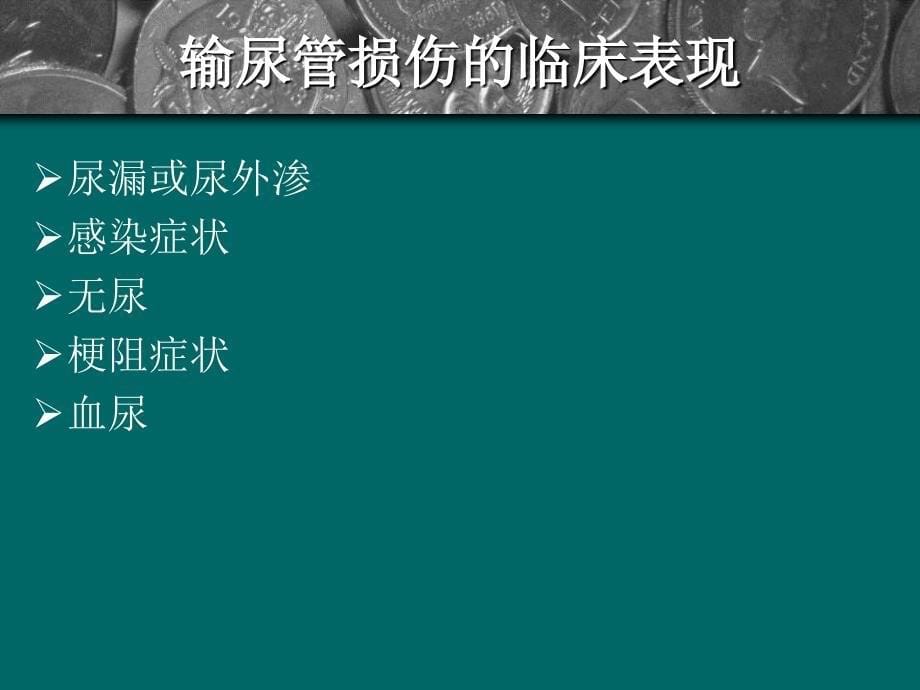 医源性输尿管损伤课件_第5页