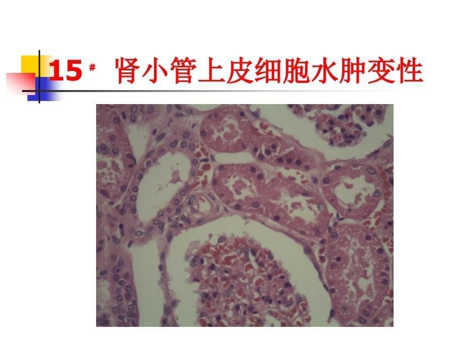 组织的损伤与修复ppt课件_第5页