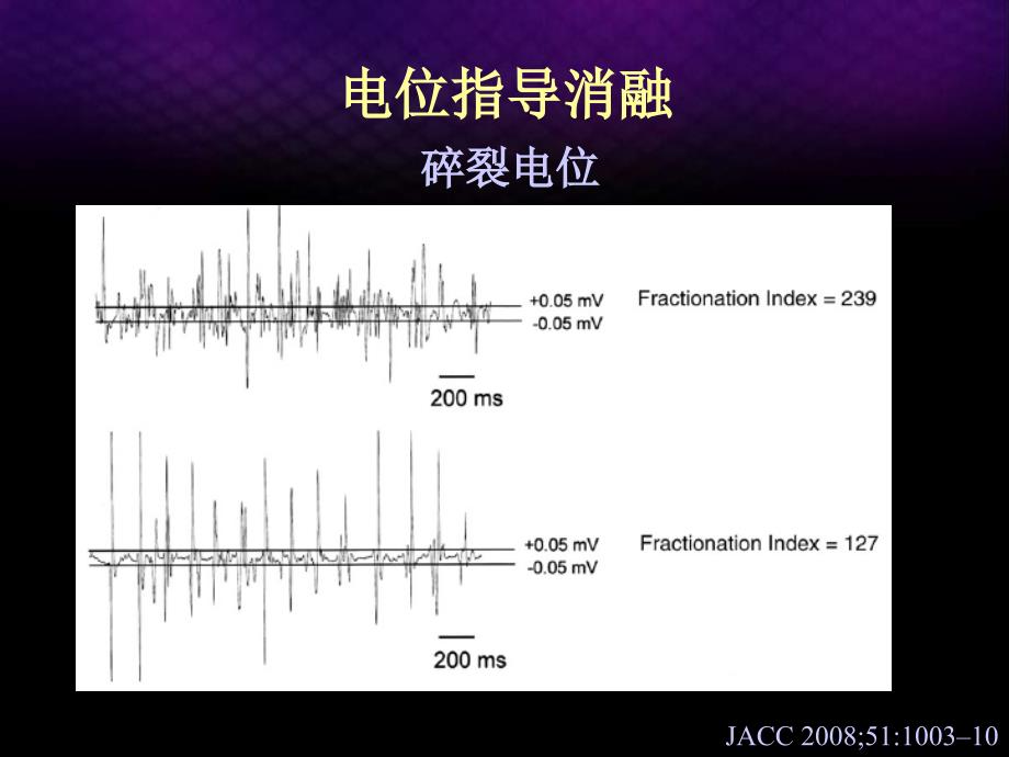 慢性房颤导管消融的技术与评价马长生课件_第4页