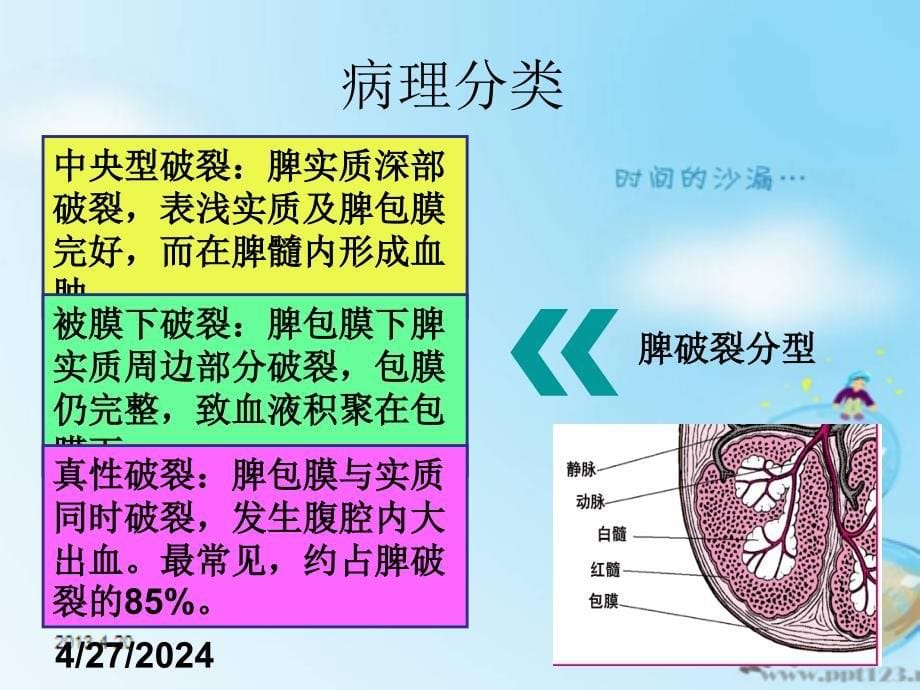 最新外伤性脾破裂的护理课件_第5页