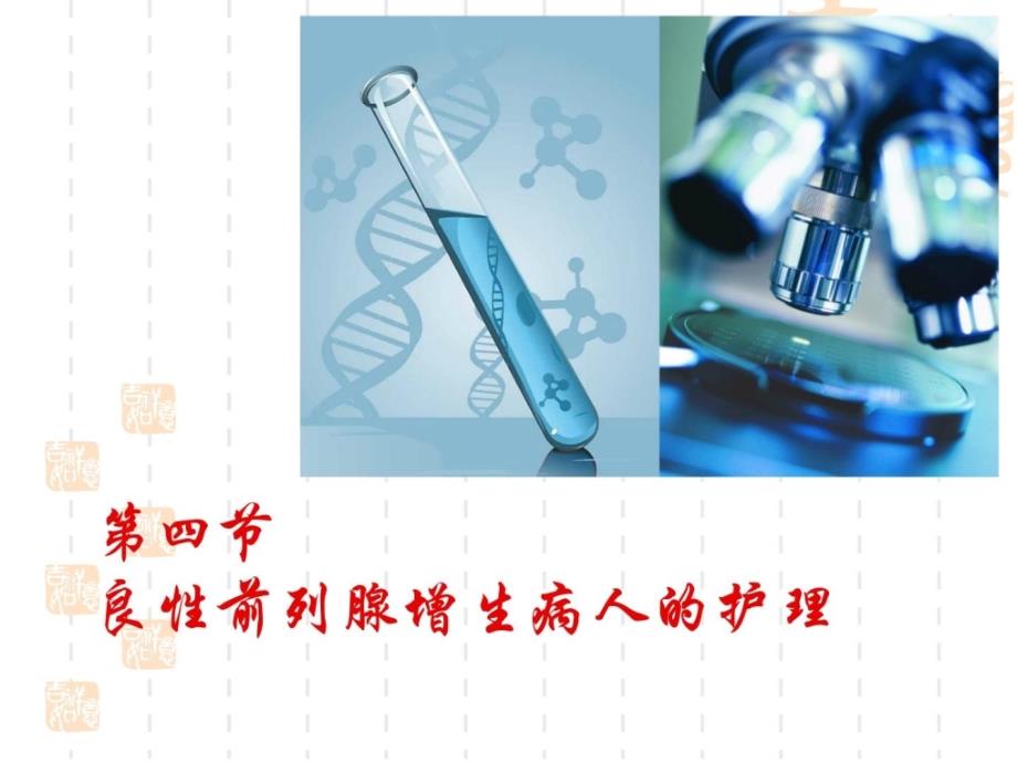 新版第十九章良性前列腺增生泌尿系肿瘤课件_第2页