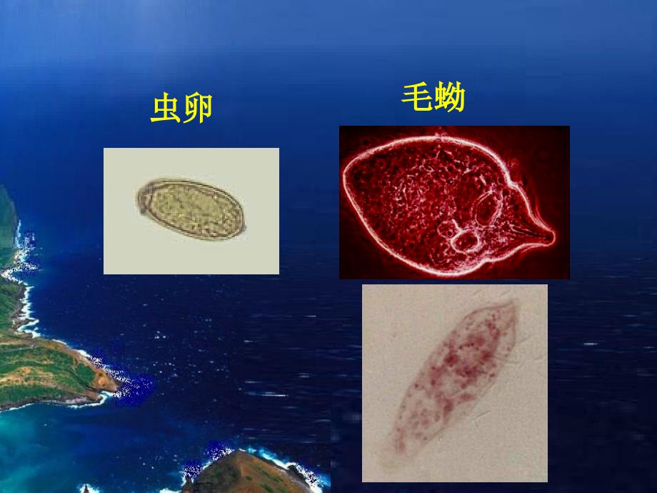 2012寄生虫检验吸虫总论姜片虫课件_第3页