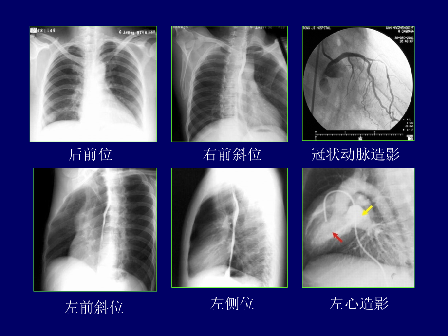 推荐医学影像诊断  (全套完整课件）课件图文详解完整版-循环系统影像诊断_第3页