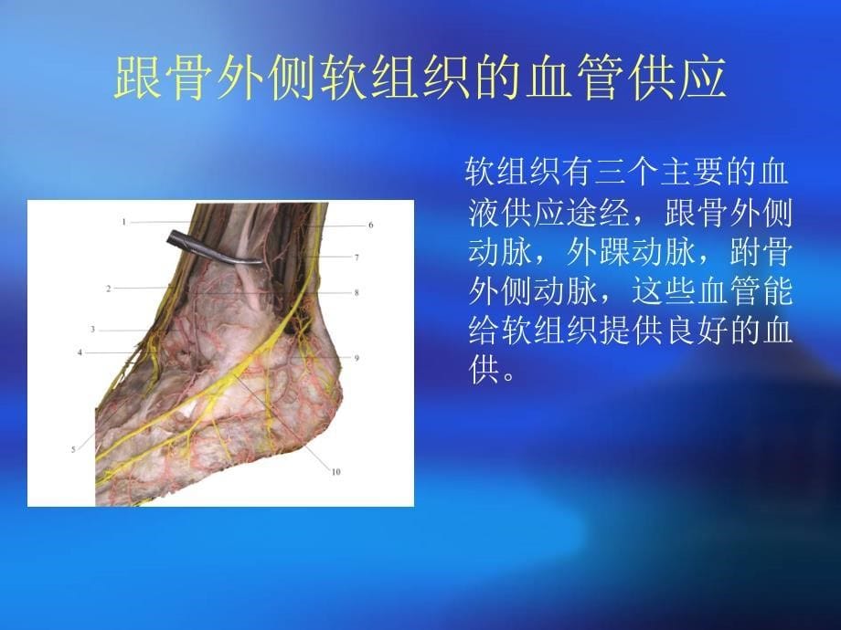 复件 跟骨骨折手术切口课件_第5页