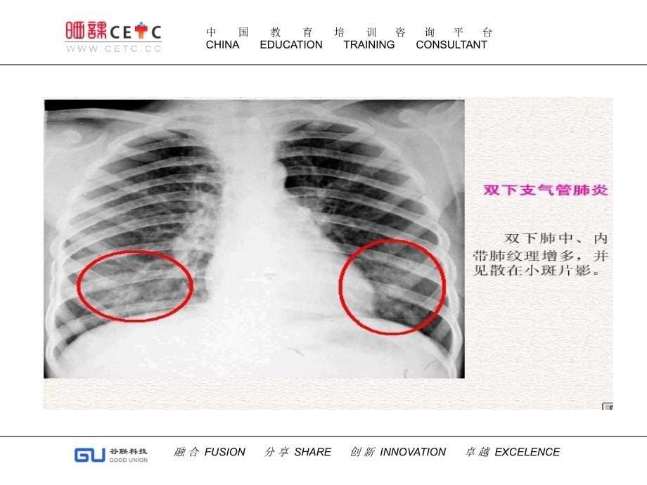 线临床执业医师实践技能考试图片精选 ppt课件_第5页