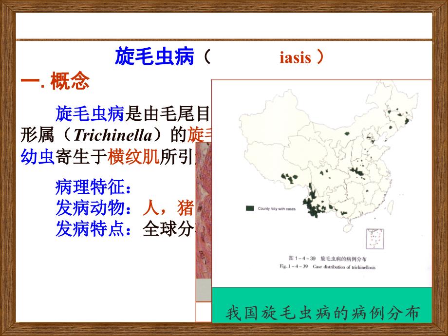 旋毛虫病ppt素材课件_第1页