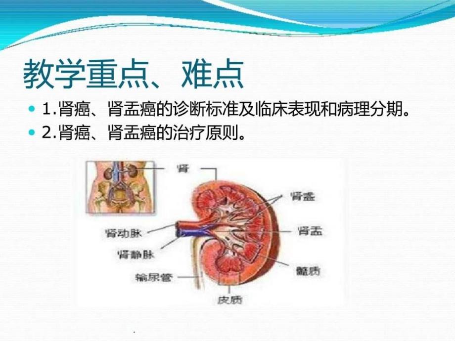 肾肿瘤课件图文_1_第4页