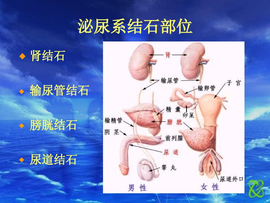 泌尿系结石课件_6_第3页