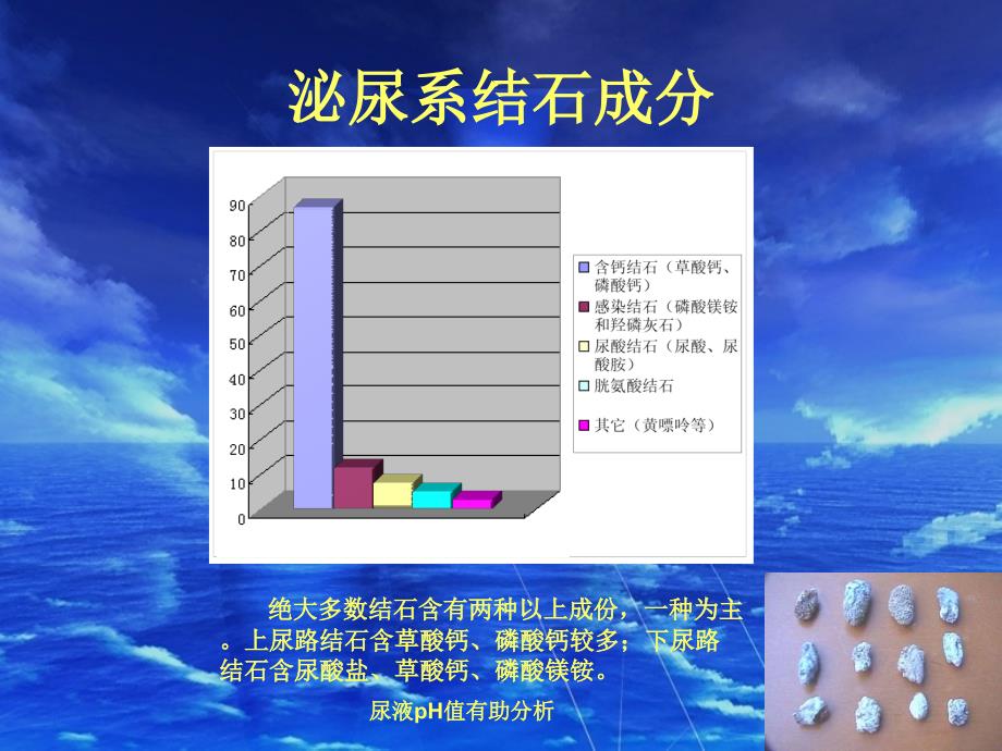 泌尿系结石课件_6_第4页