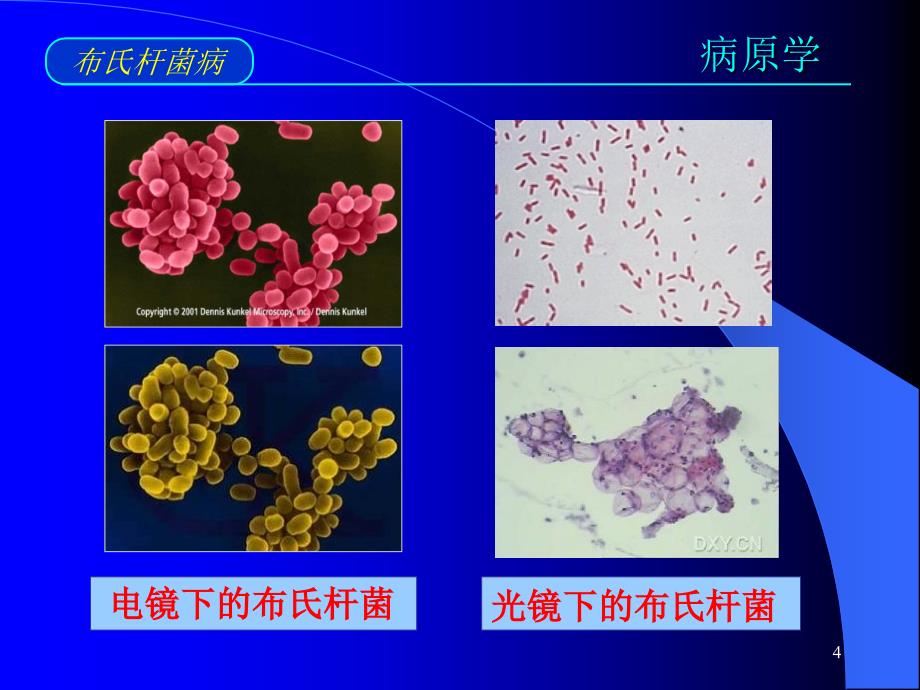 布氏杆菌病课件_1_第4页