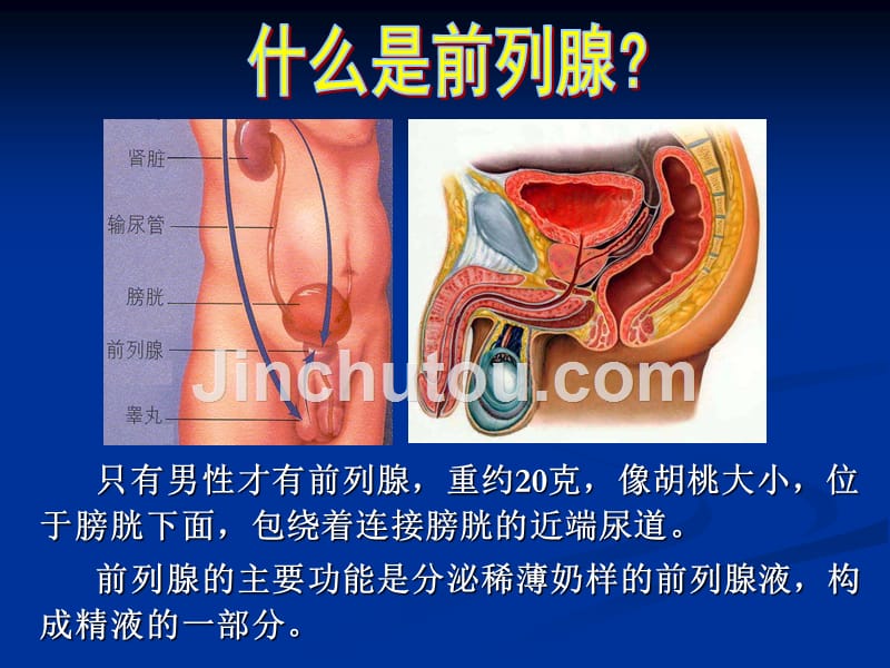 良性前列腺增生症课件_1_第2页