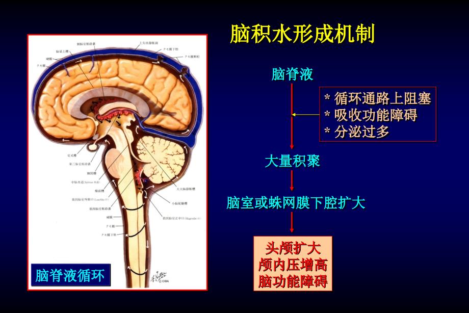 颅脑和脊髓先天性畸形课件_第3页