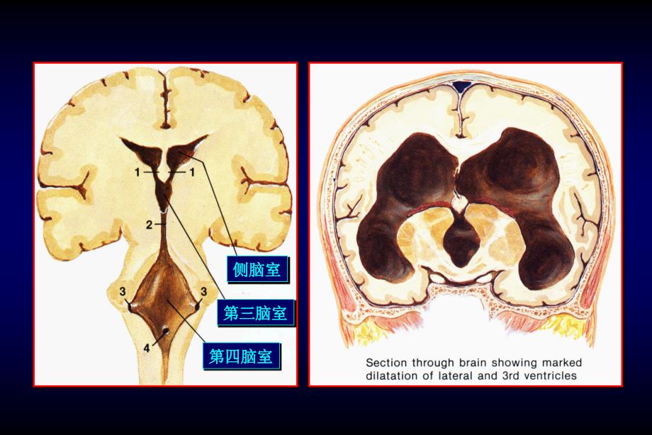 颅脑和脊髓先天性畸形课件_第4页