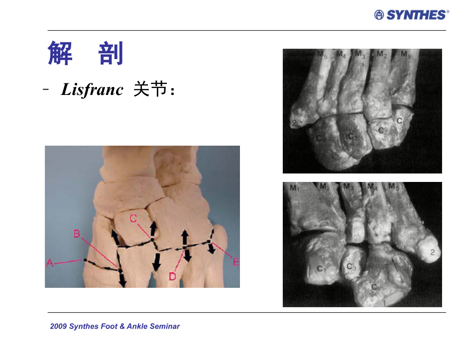 跖跗关节损伤synthesfoot ankleseminar ppt课件_第4页