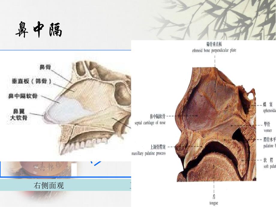 鼻中隔偏曲课件_3_第4页