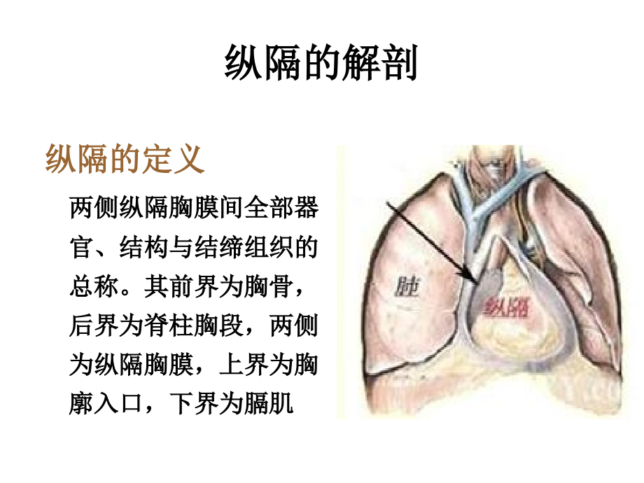 纵隔肿瘤的解剖位置及诊疗 ppt课件_第3页