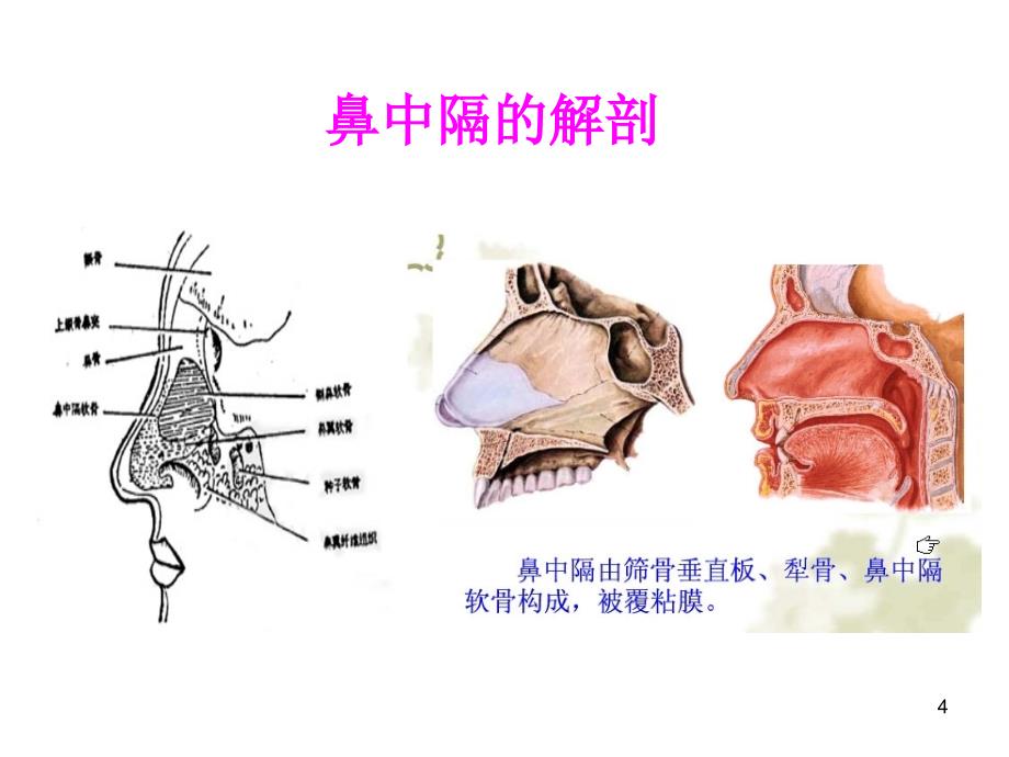 鼻中隔偏曲矫正术新课件_2_第4页