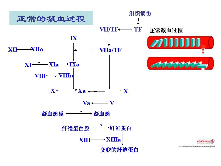 血友病的诊断课件_1_第4页