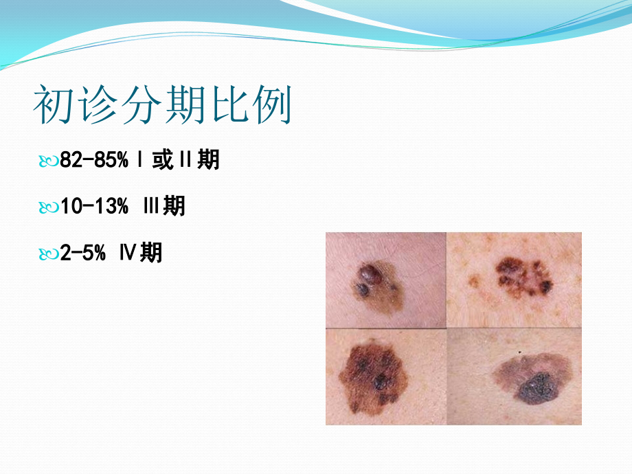 黑色素瘤刘峰课件_第4页