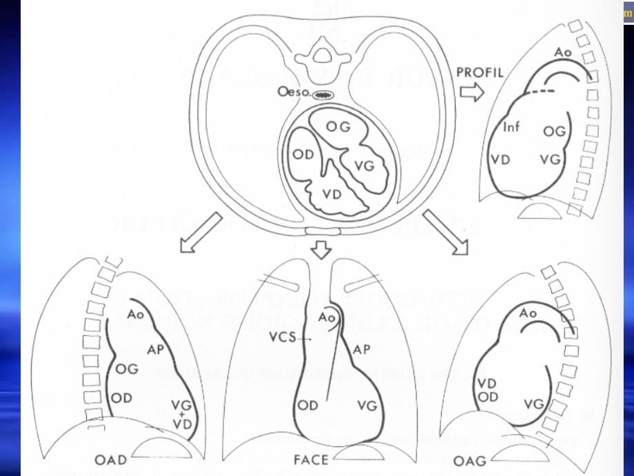 心脏与大血管影像学_2课件_第5页