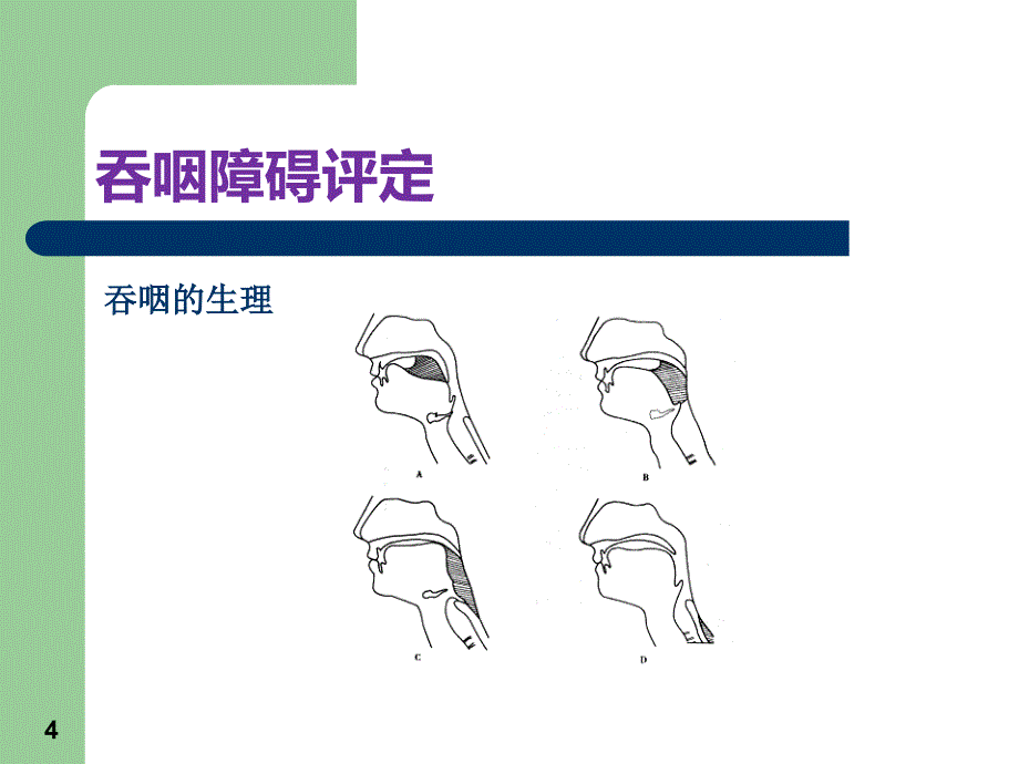 吞咽功能评定ppt课件_第4页