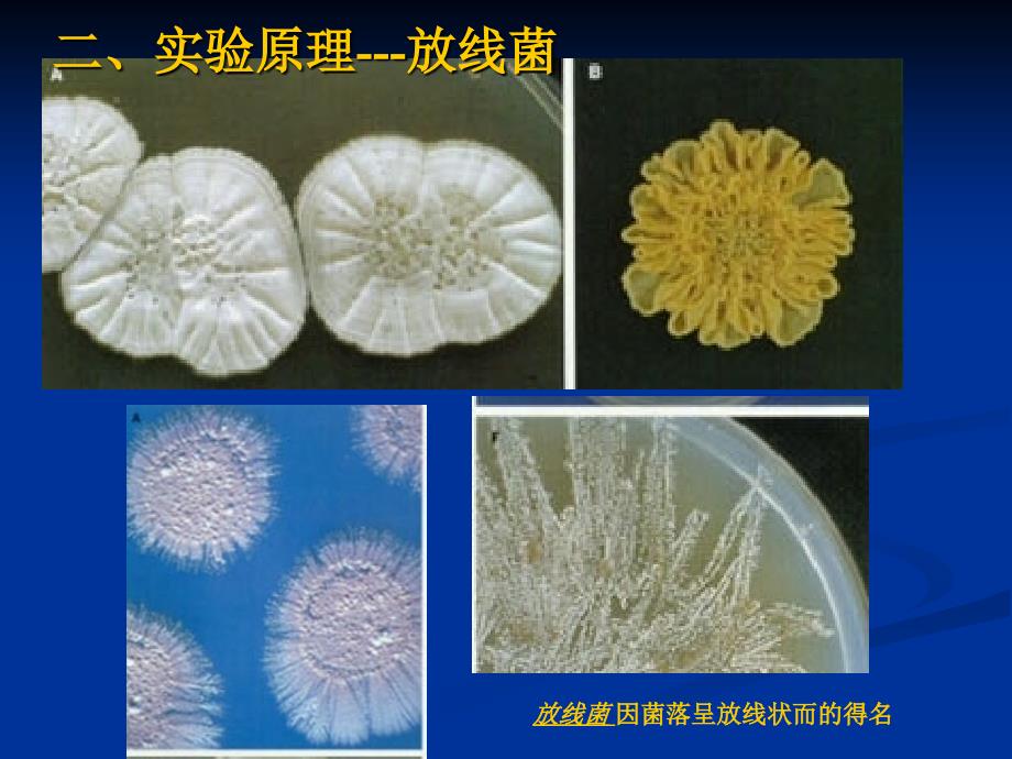 微生物实验四放线菌霉菌酵母菌的形态观察（ppt x页）课件_第3页