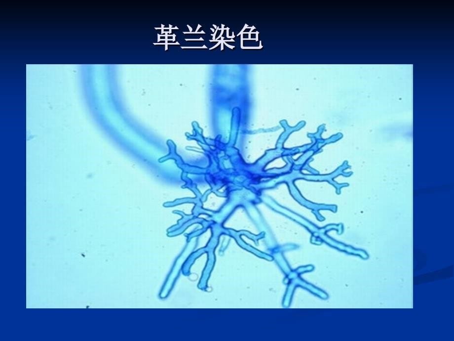 微生物实验四放线菌霉菌酵母菌的形态观察（ppt x页）课件_第5页