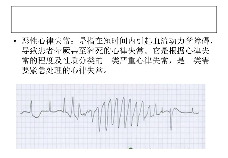 围术期恶性心律失常的识别及处理课件_第3页