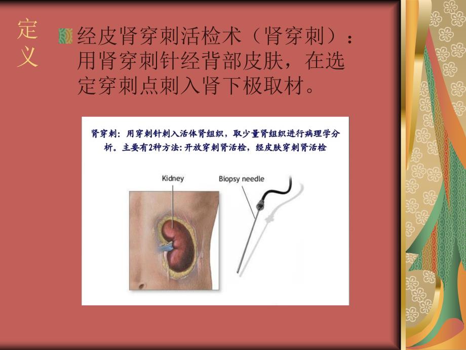 肾穿刺活检术_1课件_第3页