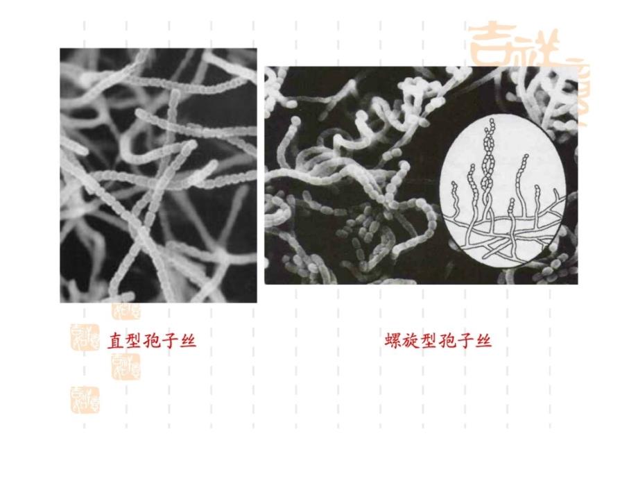 放线菌酵母菌霉菌的观察迟疑及微生物大小的测量精彩课件_第4页