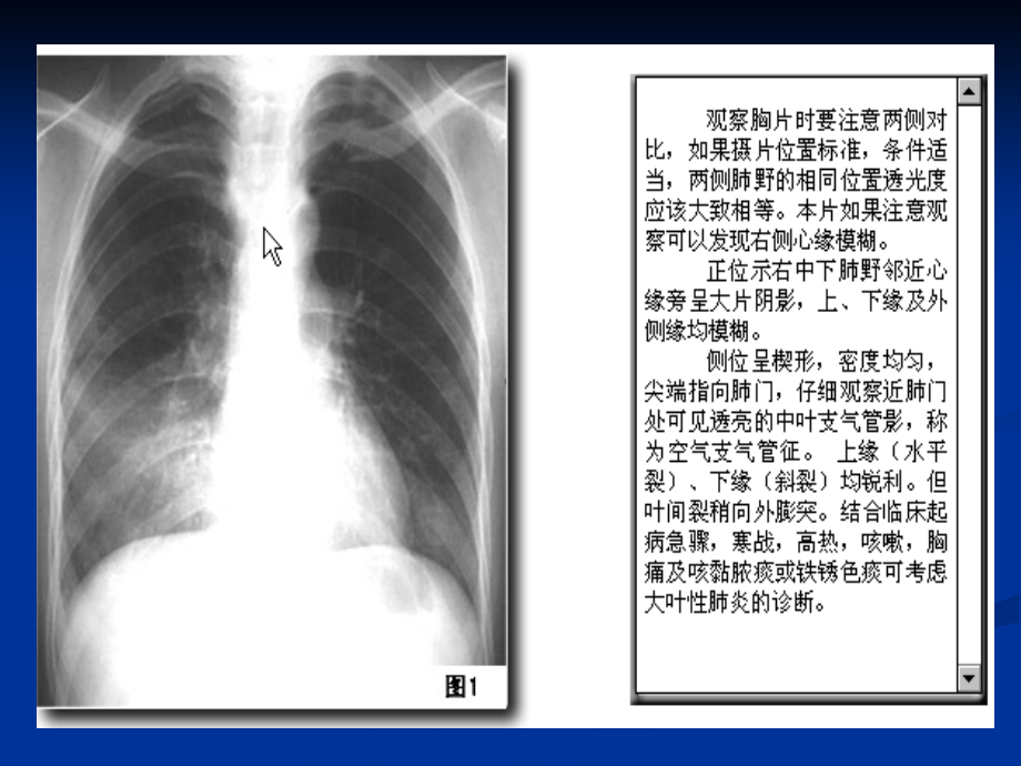 执业医师资格技能考试x线培训_课件_第3页