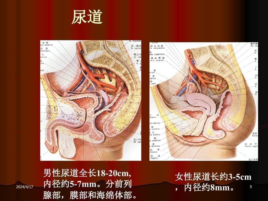 尿石症图文课件_第5页